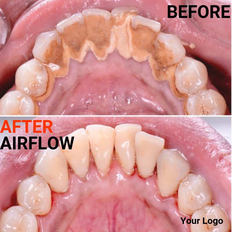 A Preventive Mindset for Lifelong Oral Health