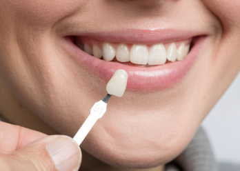Can you get veneers with missing teeth?