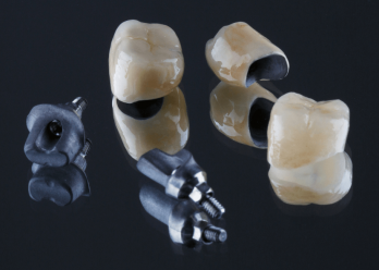 Dental crowns explained: everything you need to know