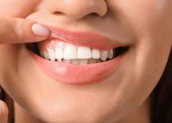 Our comprehensive guide to tooth enamel